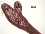 5 - Soro di tetrasporocisti